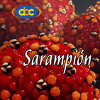 El Ángel de tu Salud - SARAMPIÓN
