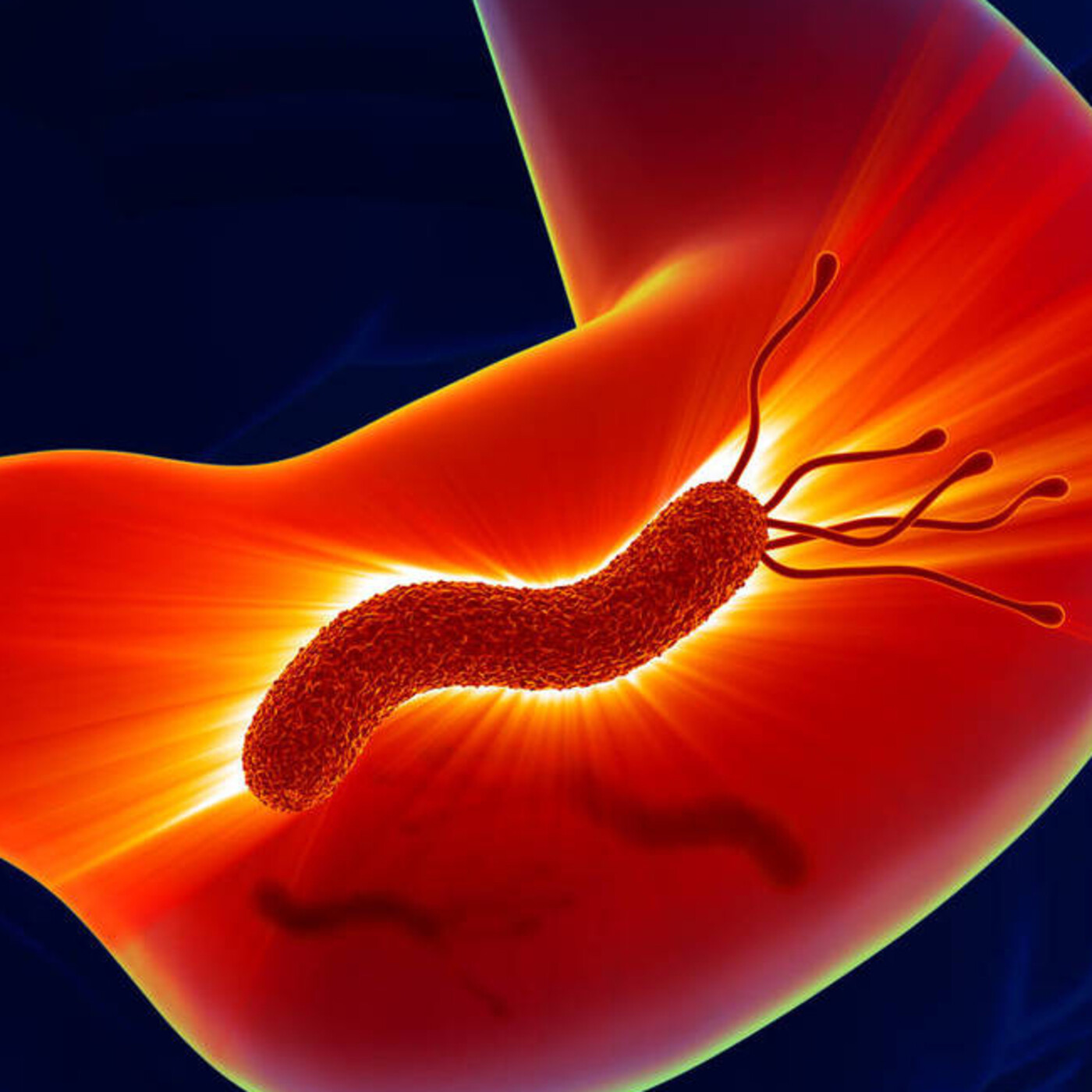 40. Caso Clínico #2 [Desenlace - Natalia]