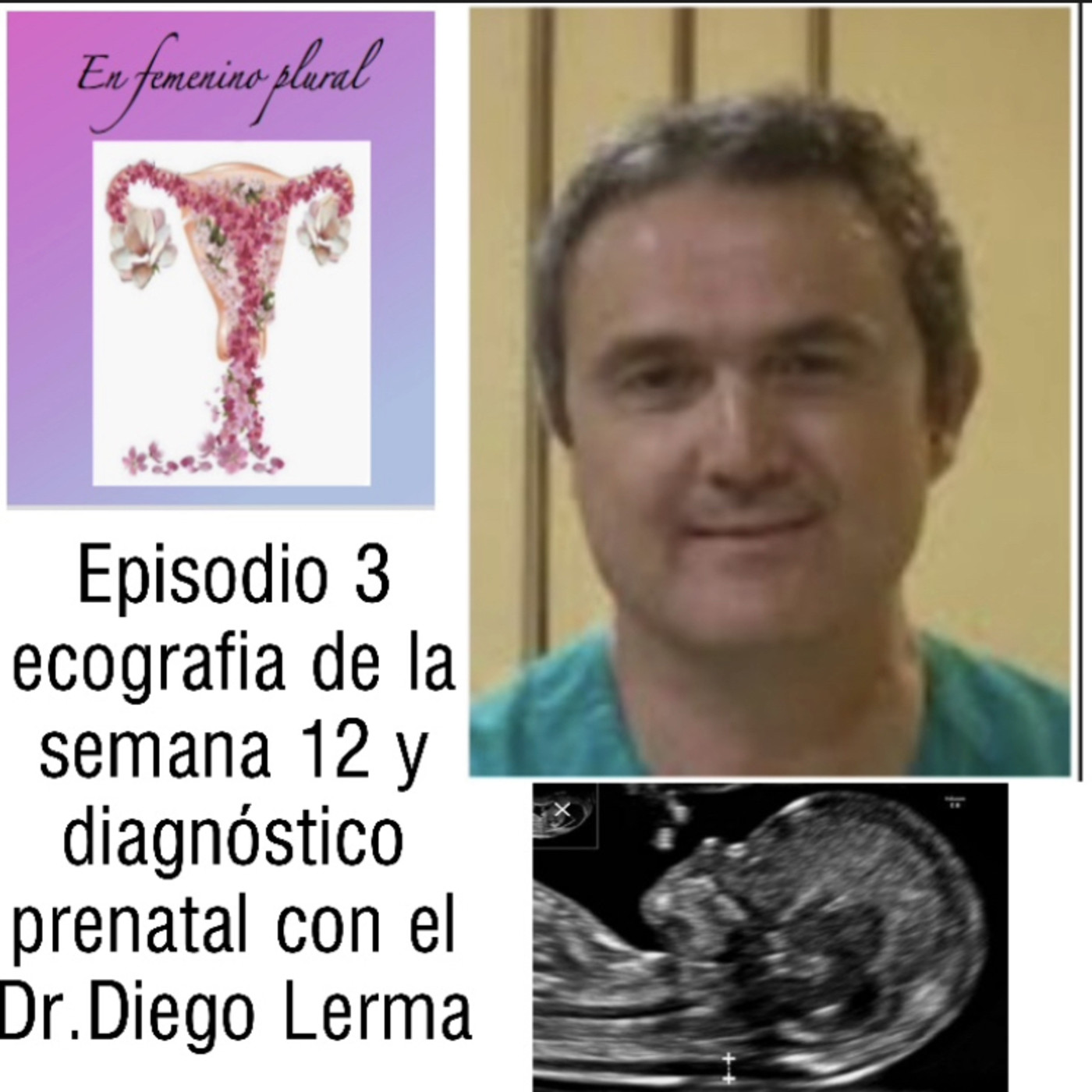 EN FEMENINO PLURAL