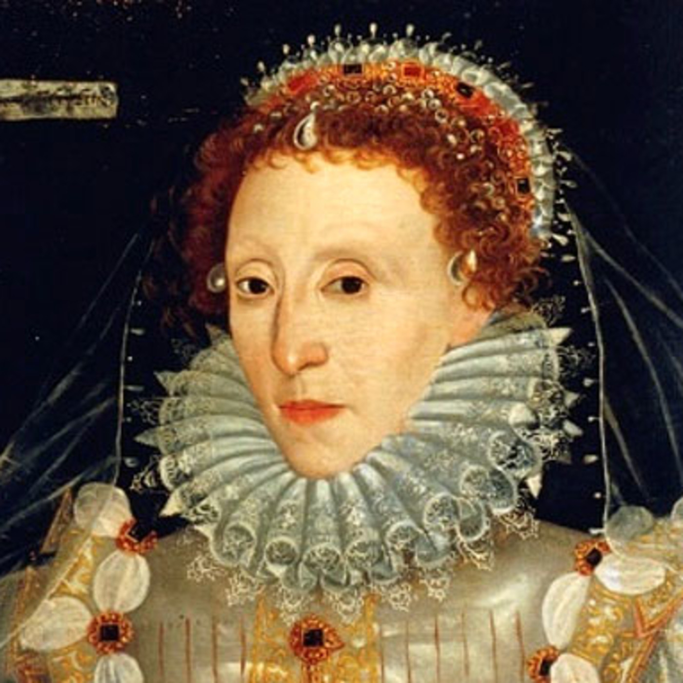 Micro1. Elizabeth I y la sífilis.