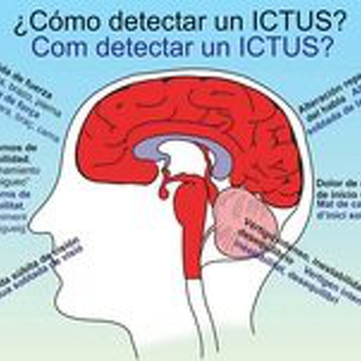 Saludario. Programa 6. El ictus se puede tratar y prevenir (31-10-2013) episode artwork