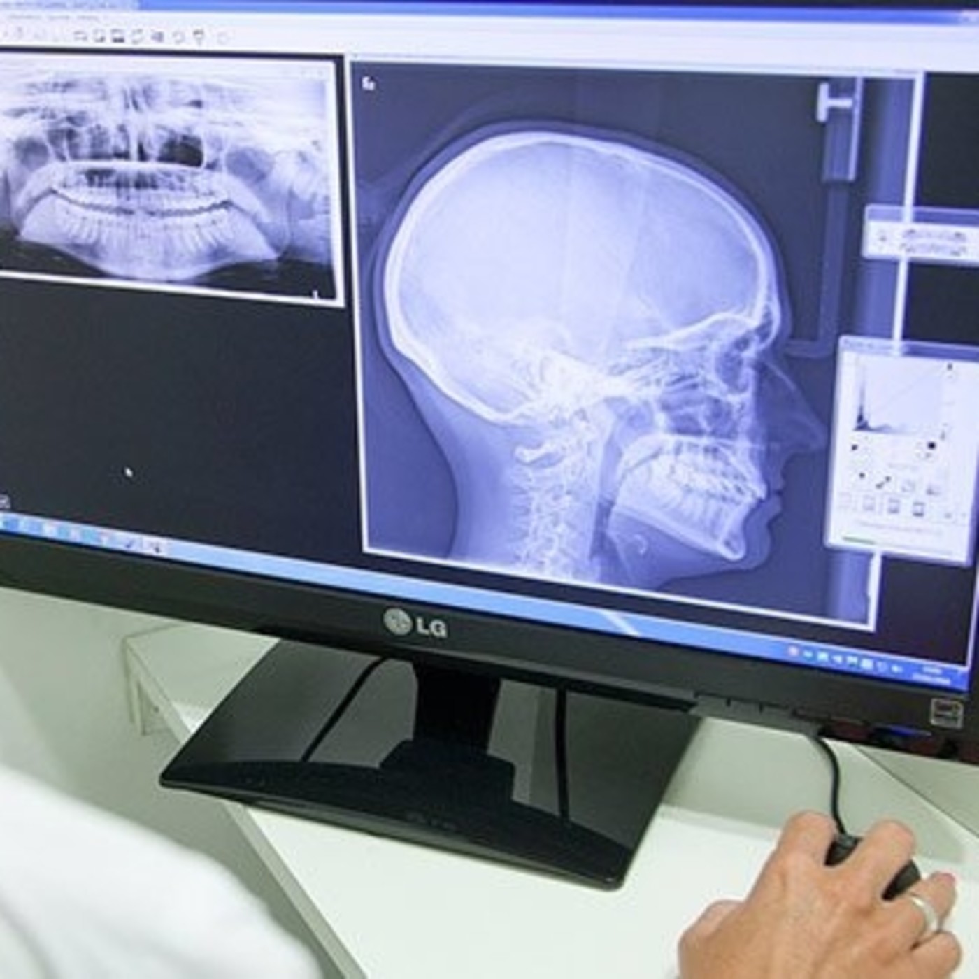 Salud Bucodental