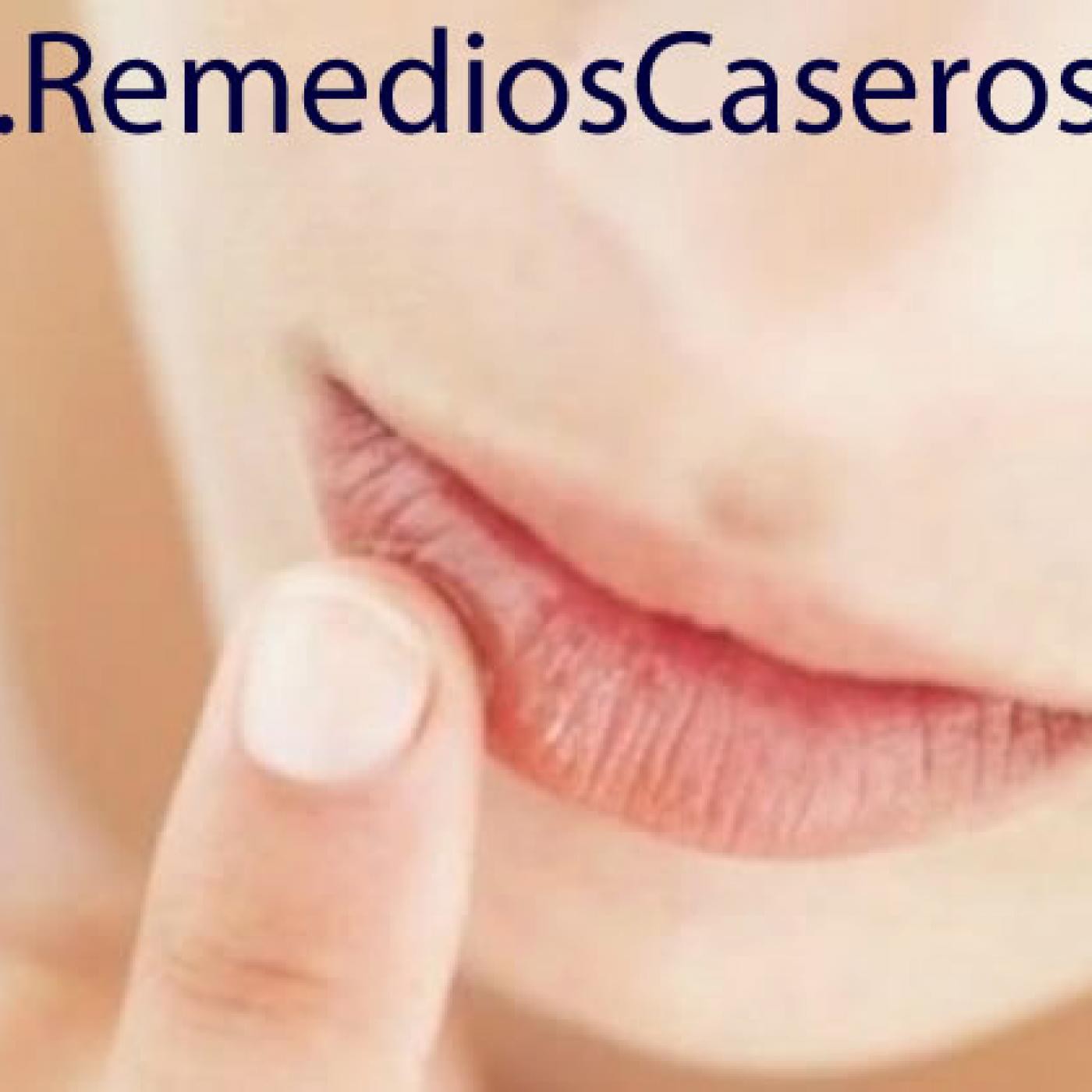 Remedios Caseros