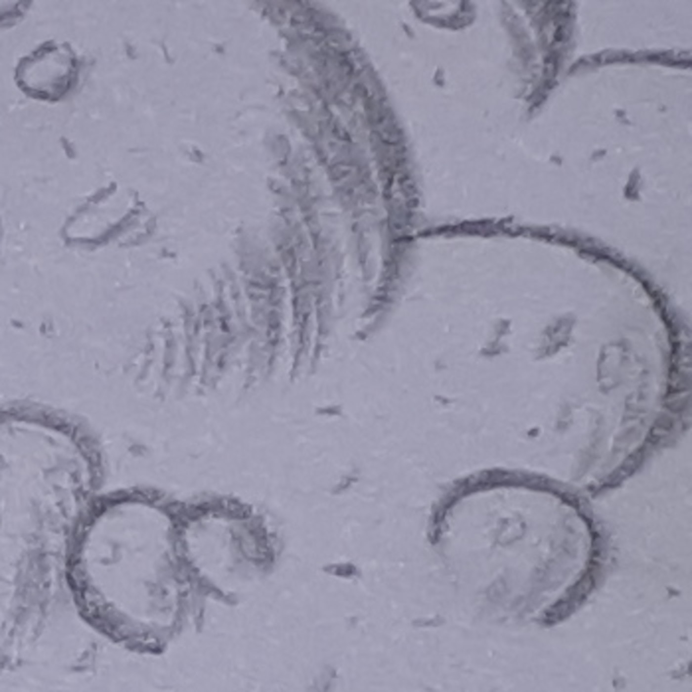 Generación Random 2x39 - La vida aplasta a Fili episode artwork