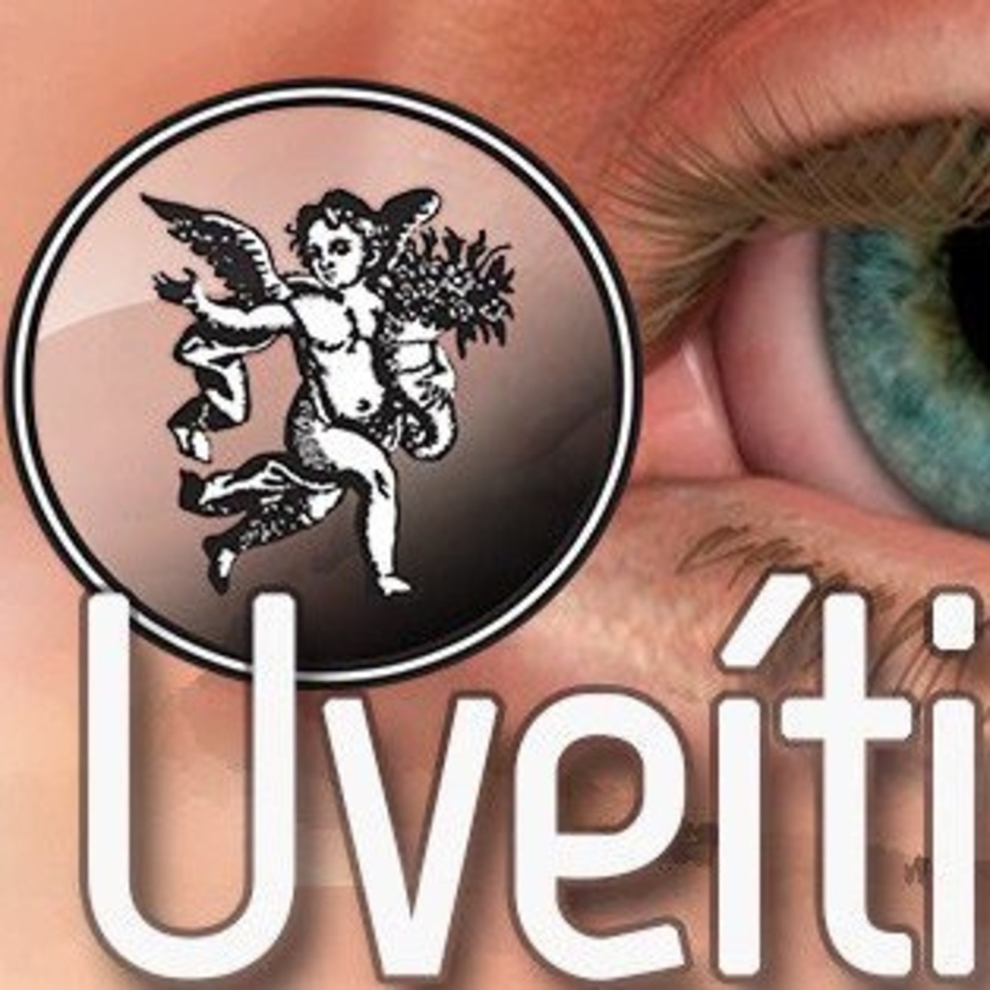 El Angel de tu Salud - UVEITIS