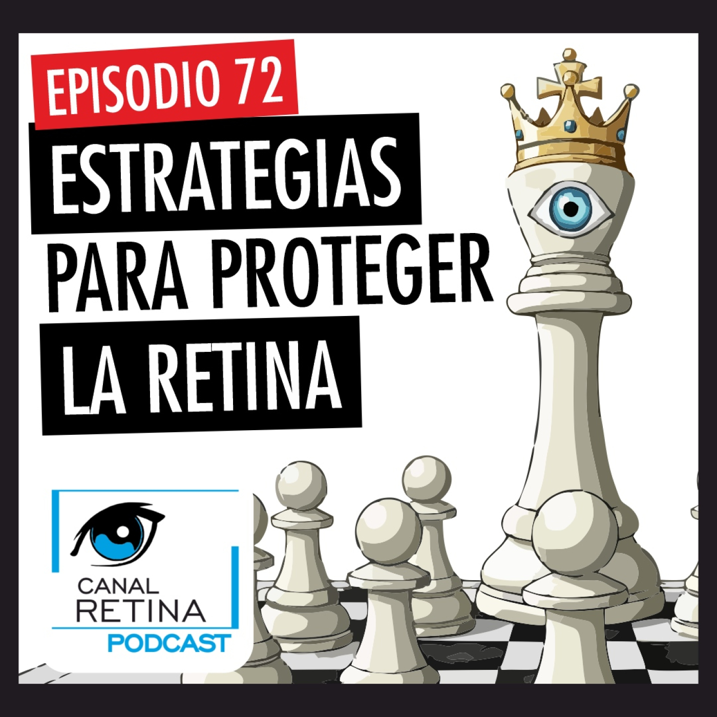 Episodio 72 - Estrategias para proteger la retina