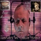 Diario de Bitácora 19: Trasplantes de Cabeza Humana · Duende Momia · Objetos Extraterrestres Egipcios