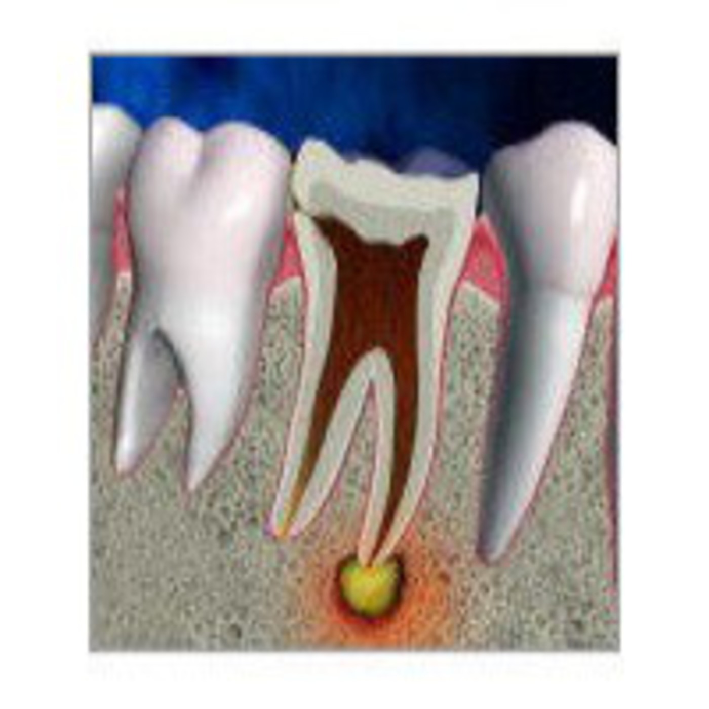 Unidad 1. Introducción al estudio de la endodoncia