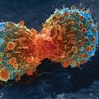 Con un cáncer y después (20)