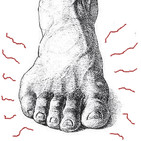 Significado del dolor en los pies