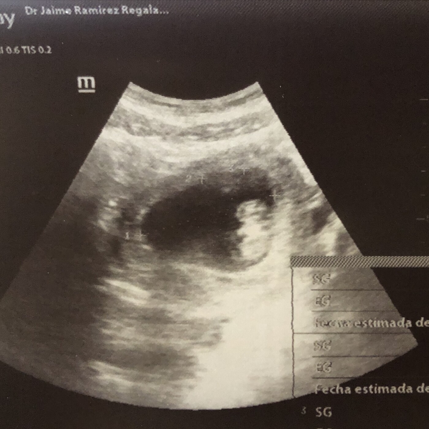 Despertar Consciencias Para Vivir Con Propósito