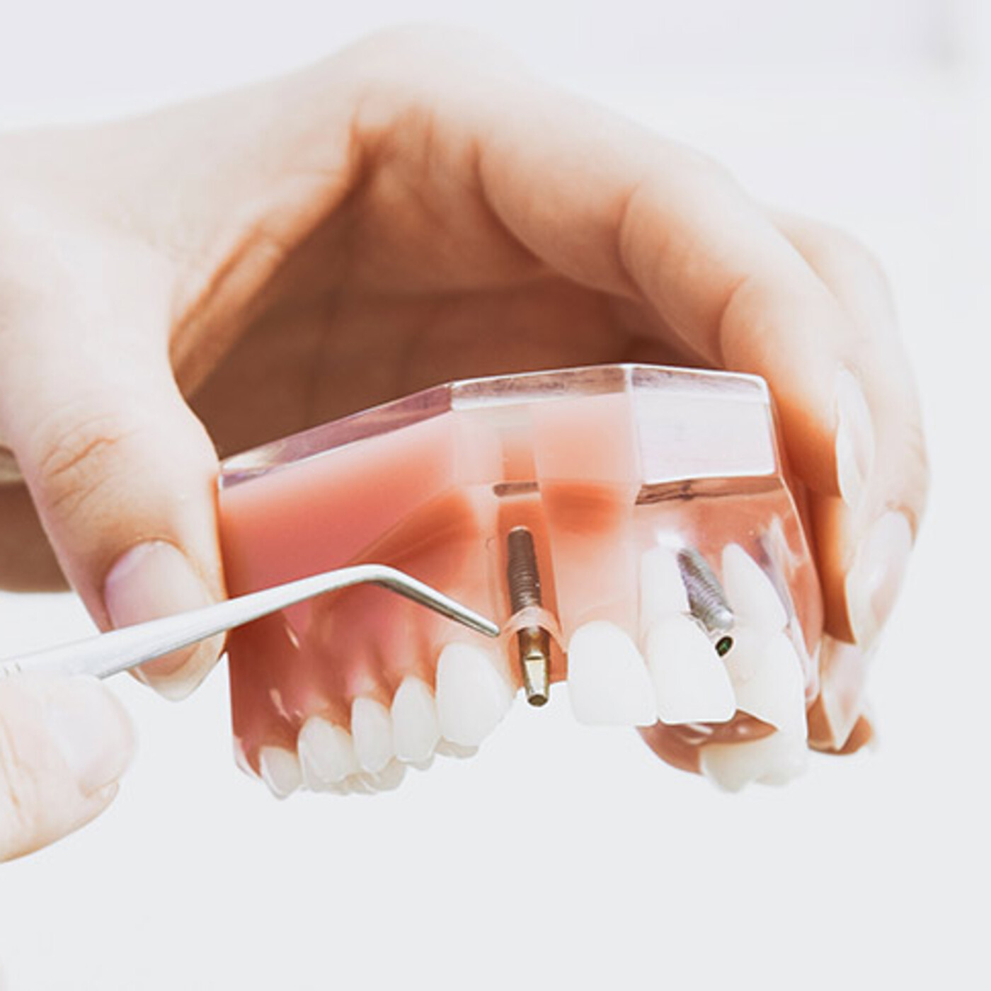 Salud Bucodental
