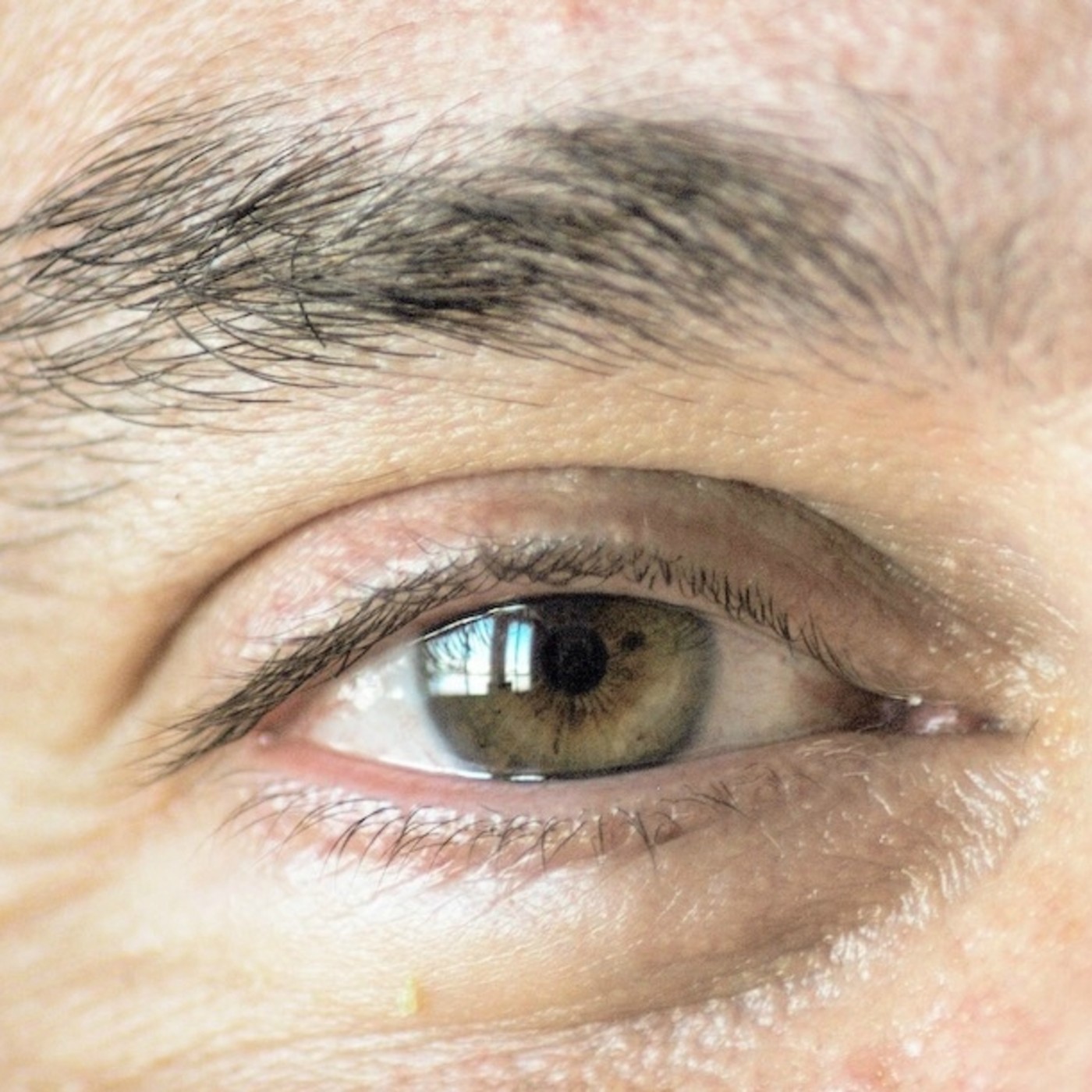 Ojo de Pez