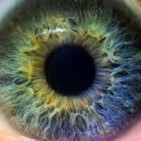 Distensión ocular