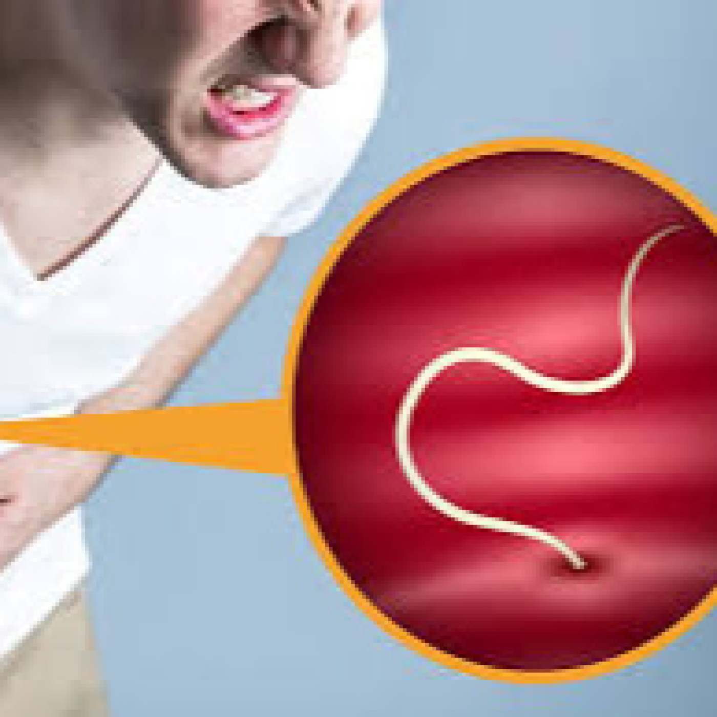 Infecciones parasitarias por nematodos: síntomas, consecuencias y tratamiento