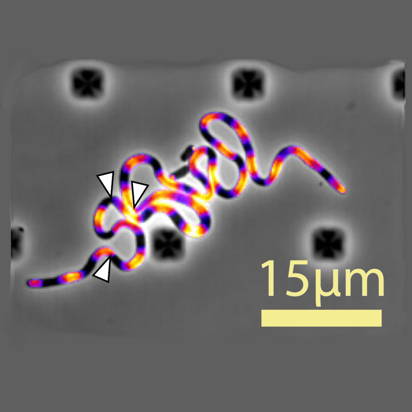 Aparici en Órbita s08e14: La biofísica de los filamentos bacterianos