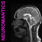 The Neuromantics – Episode 3