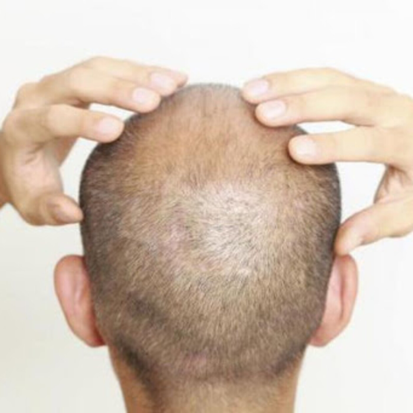 Ni un pelo de tontos!!!