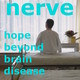 HIV related dementia