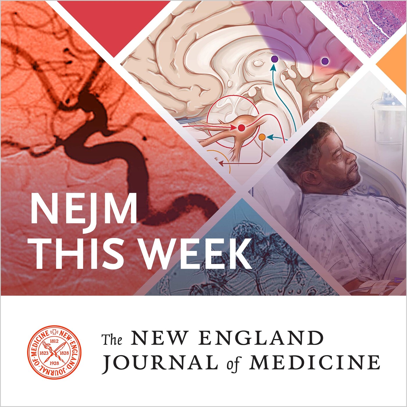 NEJM This Week — May 23, 2019